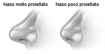 rinoplastica proiezione del naso